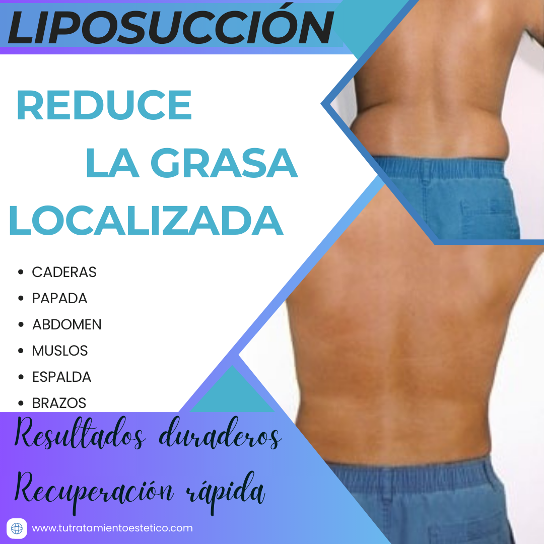 Liposucción