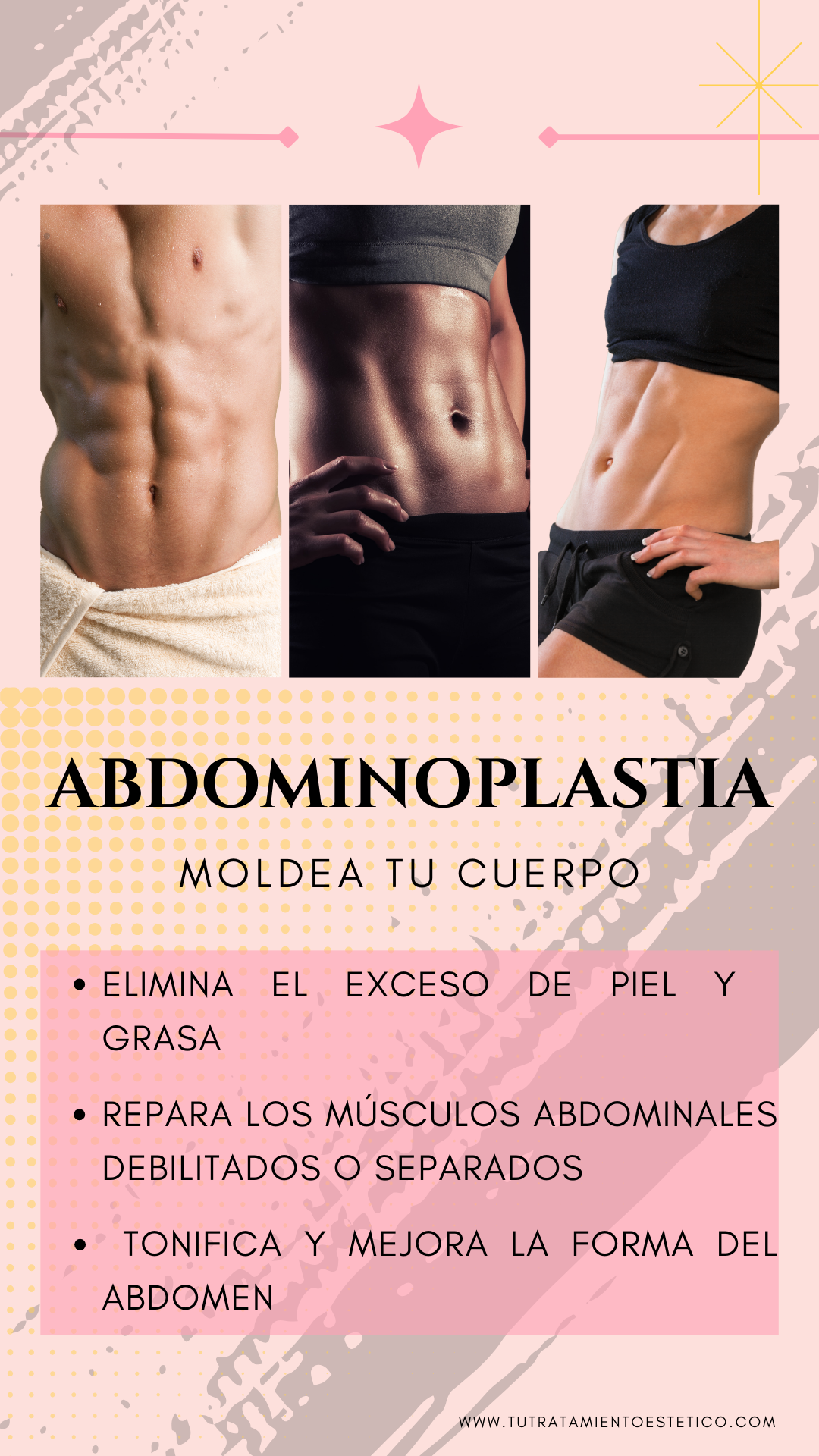  Abdominoplastia