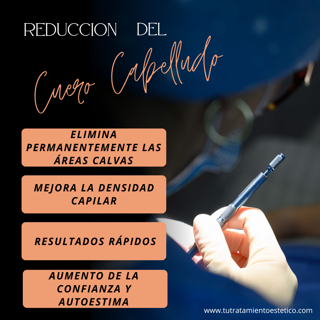 Reducción de Cuero Cabelludo