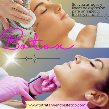 Tratamiento facial con Botox
