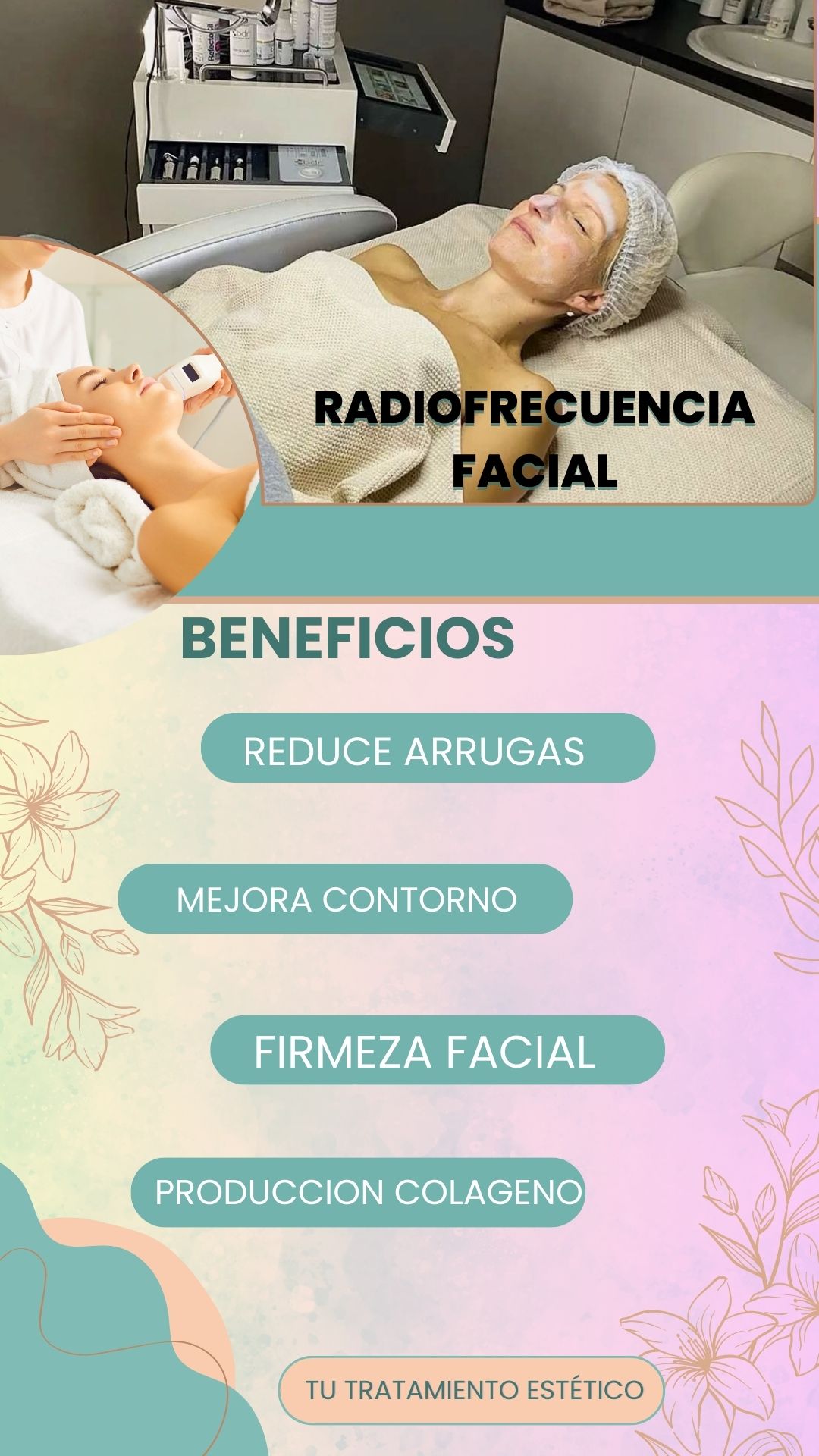 Tratamiento de Radiofrecuencia Facial