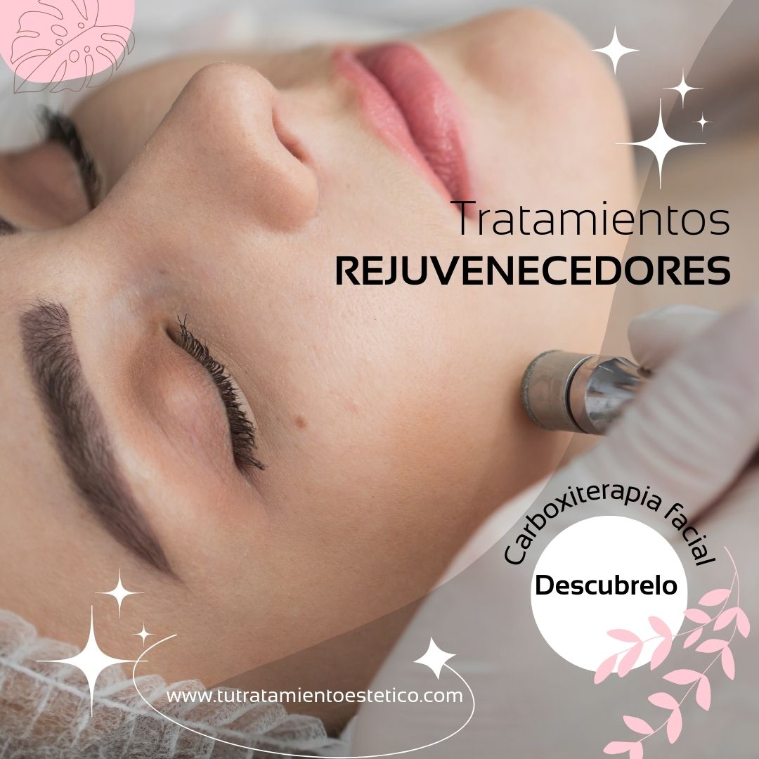 Carboxiterapia facial